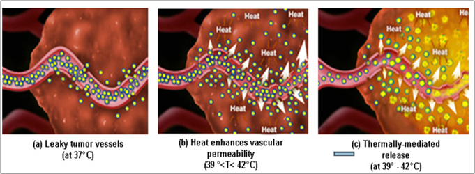Magnetic hyperthermia stem cell gene therapy diagram